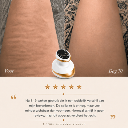 4-1 Anti-Cellulite Cupping Body Shaper