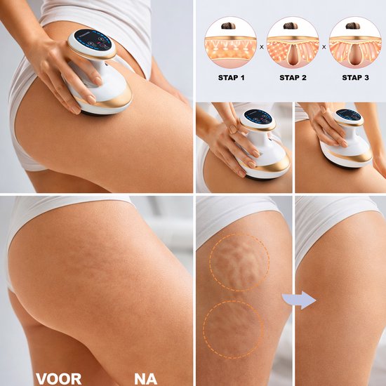 4-1 Anti-Cellulite Cupping Body Shaper