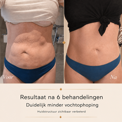 4-1 Anti-Cellulite Cupping Body Shaper